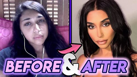 Chantel Jeffries | Before and After Transformations | Plastic Surgery Transformation
