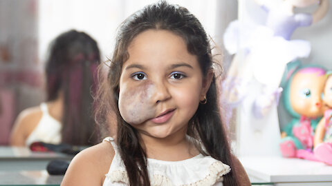 6-Year-Old With Facial Tumour Gives Make-Up Tutorials | BORN DIFFERENT