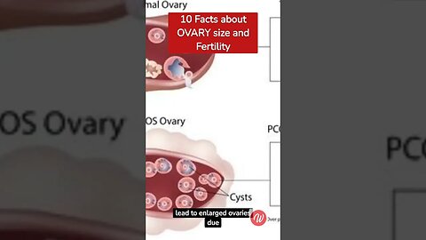 10 Facts about OVARY size and fertility #shortsfeed #fertility #trending #