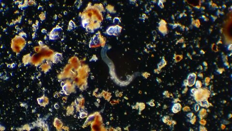 Nematode under the Microscope! Darkfield Microscopy in 2K.