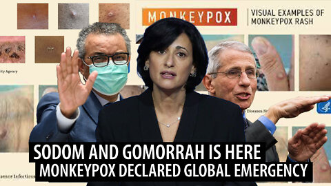 SODOM AND GOMORRAH: The WHO Declares a GLOBAL EMERGENCY as Biden Chooses 'Special Monkeypox Team'