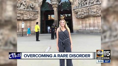 University of Arizona student diagnosed with Guillain–Barré syndrome to be released from hospital