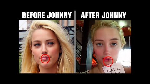 Expert RAGES On Amber Heard For Falsely Accusing Johnny Depp Of Her Cracked Lips