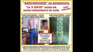 The Cure For Parkinson's Disease Found, In Dr. James Parkinson's 1817 Book