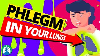 Top 10 Ways to Get Rid of Constant Mucus and Phlegm in Your Throat