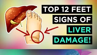 12 Signs Your Feet Give About Liver Problems