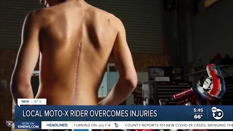 El Cajon motocross racer overcomes injuries to keep driving