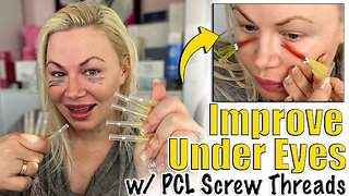 Improving Under Eyes with PCL Screw Threads, AceCosm | Code Jessica10 Saves you Money