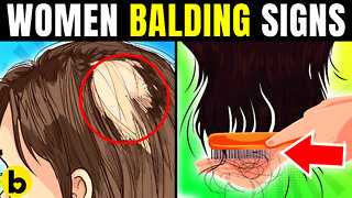 4 Major Warning Signs Of Balding In Women