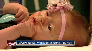 St. Pete hospital believes it has highest survival rate for rare birth defect