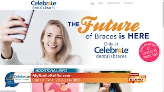 Braces That Are Affordable!