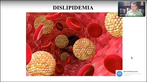 CLASE 57 - DESLIPIDEMIA #2 - NICOLAS BARRIOS