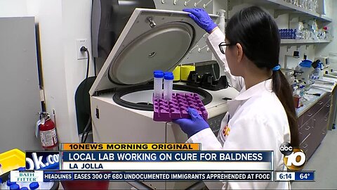 La Jolla lab working on cure for baldness