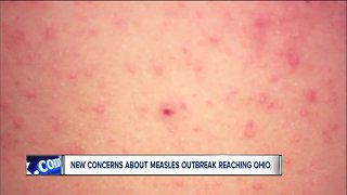 Holiday travel could potentially bring measles outbreak to Ohio