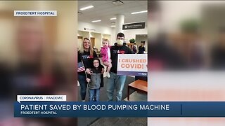 27-year-old Wisconsin man critically ill with COVID-19 saved thanks to blood pumping machine