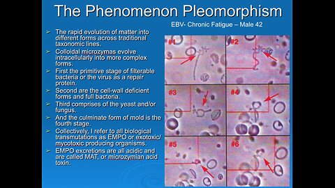 The Validation of Biological Transformation or Pleomorphism of the Red Blood Cell Into Bacteria