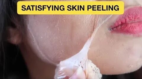 🌟 Say Goodbye to Peeling Skin! 🌟 Effective Skincare Tips & Remedies ✨