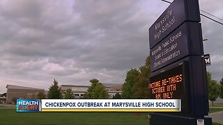 Chickenpox outbreak at Marysville High School