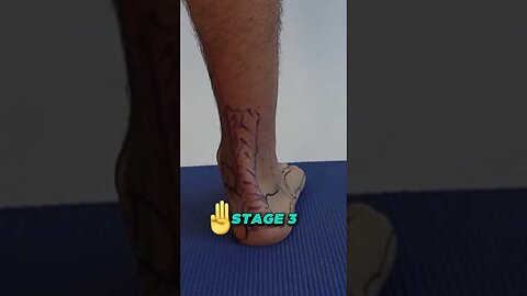STAGE 4 Inside of the Ankle Pain [ Posterior Tibial Tendonitis ]
