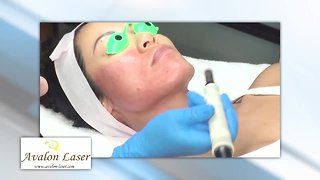 Avalon Laser offers the latest Aesthetic Technologies for our San Diego and Carlsbad clients