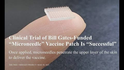 👀 Bill Gates 'GAVI' Funded 'Microneedle' vaccine patch to 'help' counter 'needle' hesitancy..