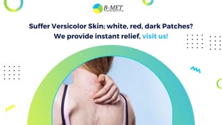 Struggling with transmitted or skin diseases? Get Relieved With B-Met Solutions!