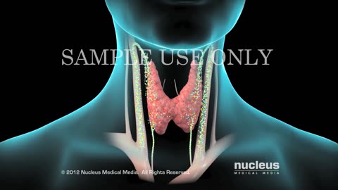 THYROIDECTOMY: DEFINITION, SIGNS AND SYMPTOMS, TREATMENT AND EVALUATION