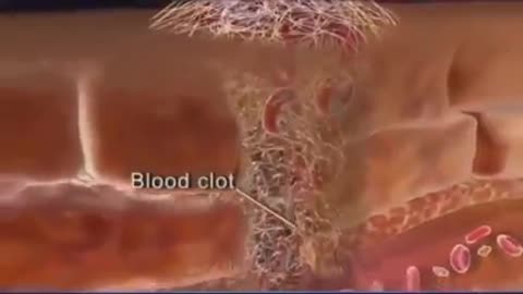 Why blood not lose from body after injury