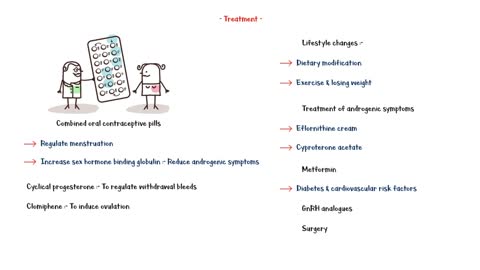 Polycystic Ovarian Syndrome (PCOS) - Causes, Signs & Symptoms, Diagnosis & Treatment