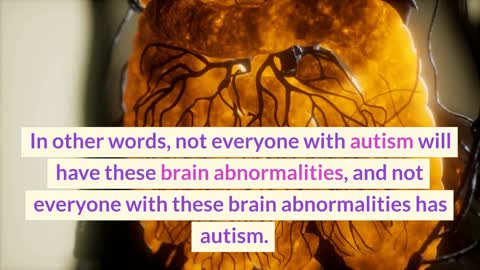 Can a brain scan detect autism?#autism #autismawareness