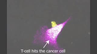 TCell Attacks And KiIIs #Cancer Cell