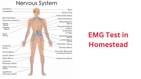 Ultimate Diagnostic Center : #1 EMG Test in Homestead, FL