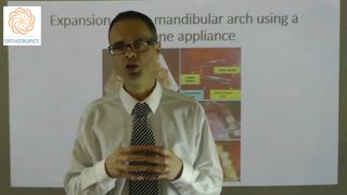 Expansion of the Mandibular Arch (Lower Jaw) Using a Trombone Appliance by Dr Mike Mew