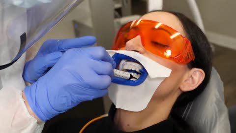 Teeth Whitening Procedure at Dental Clinic