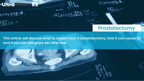 Sex After Prostatectomy: How Does Prostate Surgery Affect Your Sex Life?