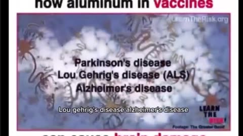 Neuroscientist Explains Link Between Aluminium and Brain Damage