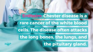 The Causes And Diagnosis Of Erdheim - Chester Disease