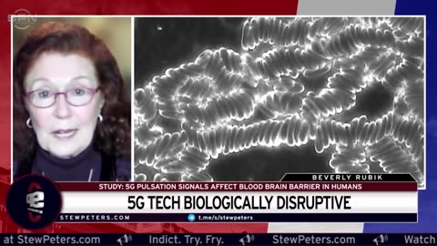 5G Technology Is BIOLOGICALLY DISRUPTIVE: 5G Radiation PENETRATES Human BLOOD BRAIN BARRIER