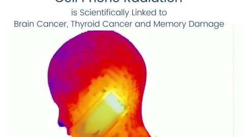 Cell Phone radiation causes cancer and memory damage