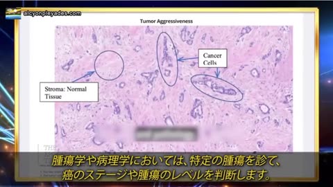 ライアン・コール博士：ワクチン前にはターボ癌は存在しなかったが、迷わず通る場所に出現している