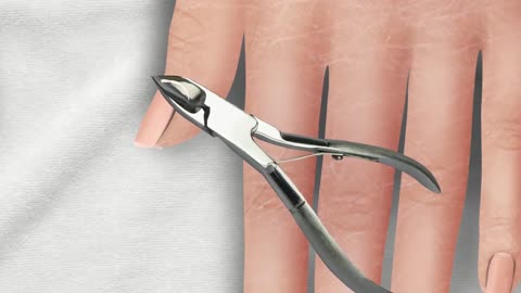 ASMR Damaged nail removal treatment animation due to hammer impact | 망치 충격으로 인한 손상된 손톱 제거 치료 애니메이션