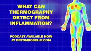 What Can Thermography Detect from Inflammation?