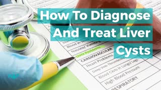 How To Diagnose And Treat Liver Cysts