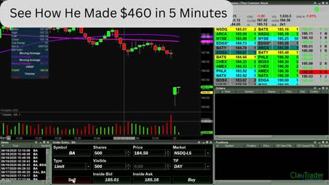 Best Stock Trading Win | See How This Person Earns $20000 In Just 5 Minutes