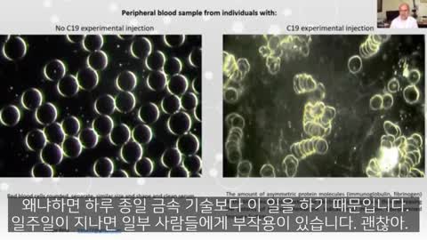 백신이 혈전 발생 되는 신체 변화 탐험