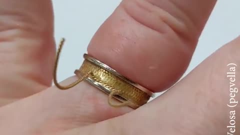 Removing Wedding Ring From Swollen Finger After 18 Years || WooGlobe