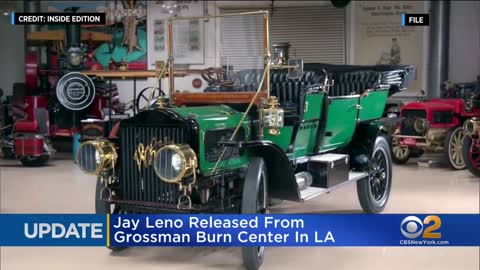 Jay Leno released from Los Angeles burn center