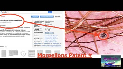 MORGELONES: El parásito patentado de las mascarillas chinas analizado al microscopio