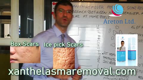 THE XANTREMOVER AND THE BREAKING MODE TO REMOVER ATROPHIC SCAR