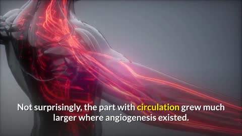 Cancer Link To Angiogenesis What Is It